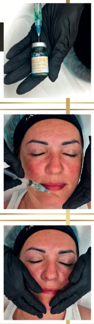 JALUPRO GLOW PEEL - 6 x 5ml